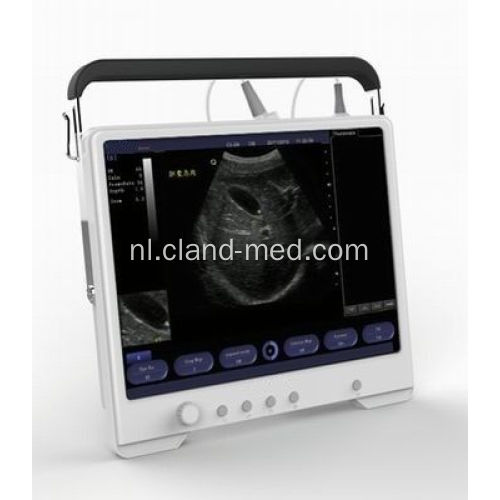 Draagbare Ultrasound Scanner Digitale echografie Machine Prijs